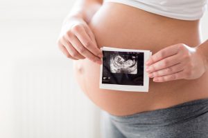 Ultraschallbild vor Bauch einer Schwangeren / Fotolia