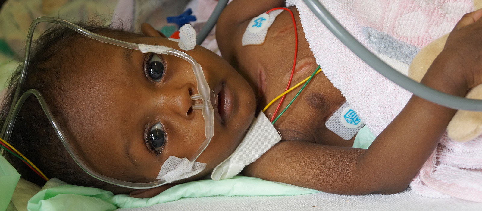 Setenbreite Herzkind Mara Ausland