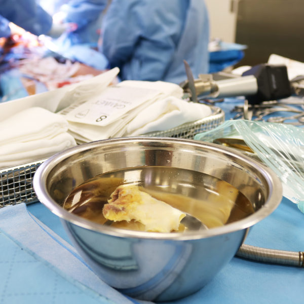 Das lebensrette Transplantat kurz vor der Implantation - eine Herzklappe aus der Gewebespende - realisiert im Netzwerk der DGFG